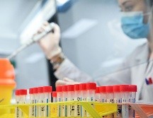 Las variantes son versiones diferentes del coronavirus inicial, que aparecen con el tiempo, a causa de varias mutaciones. Es un fenómeno normal en la vida de cualquier virus. AFP / J. Tallis