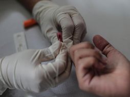 Una mujer realiza un examen de sangre para el diagnóstico de COVID-19 hoy, en un puesto de salud de la ciudad de Río de Janeiro, Brasil.  EFE/ A. Lacerda