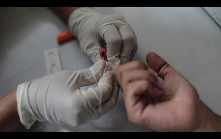 Una mujer realiza un examen de sangre para el diagnóstico de COVID-19 hoy, en un puesto de salud de la ciudad de Río de Janeiro, Brasil.  EFE/ A. Lacerda