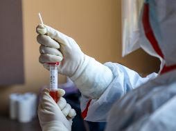 Una liberación involuntaria en laboratorio sí podría ser plausible, ya que ''aunque son raros, los accidentes ocurren y varios laboratorios del mundo trabajan con coronavirus''. AFP / ARCHIVO