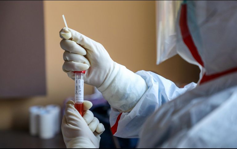Una liberación involuntaria en laboratorio sí podría ser plausible, ya que ''aunque son raros, los accidentes ocurren y varios laboratorios del mundo trabajan con coronavirus''. AFP / ARCHIVO