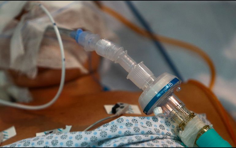 El trasplante fue realizado el pasado 2 de marzo a un hombre de 50 años, que tras la operación fue capaz de volver a respirar y hablar por sí mismo. AFP / ARCHIVO