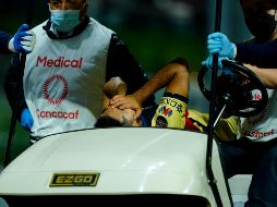 La lesión habría terminado en fractura de peroné, por lo que ''Chucho'' López sería baja del cuadro dirigido por Santiago Solari, por lo que resta del Guard1anes 2021 de la Liga MX. IMAGO7