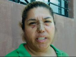 Juana Falcón fue agredida después de denunciar que le fue negado el servicio de agua en pipas. ESPECIAL