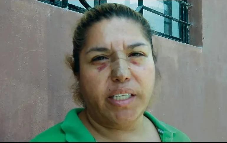 Juana Falcón fue agredida después de denunciar que le fue negado el servicio de agua en pipas. ESPECIAL