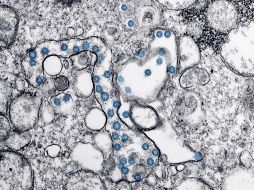 EU manifestó su insatisfacción por la investigación realizada por expertos de la OMS en Wuhan, donde buscaban el origen del virus COVID-19. AFP / ARCHIVO