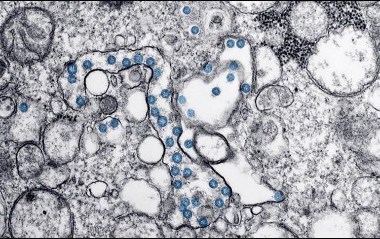 EU manifestó su insatisfacción por la investigación realizada por expertos de la OMS en Wuhan, donde buscaban el origen del virus COVID-19. AFP / ARCHIVO
