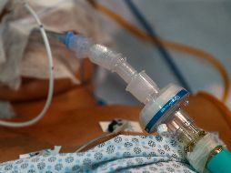 El hongro negro se ha presentado como una coinfección en pacientes de COVID-19 en países como India, y en América Latina se ha registrado un caso en Chile y otro en Uruguay. AFP / ARCHIVO