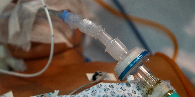 COVID-19: Detectan posible primer caso de hongo negro en M&eacute;xico