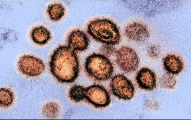 - (United States), 27/02/2020.- An undated handout picture made available by the National Institutes of Health (NIH) shows a transmission electron microscope image of SARS-CoV-2, the virus that causes COVID-19, isolated from a patient in the USA (issued 27 February 2020). Virus particles are shown emerging from the surface of cells cultured in the lab. The spikes on the outer edge of the virus particles give coronaviruses their name, crown-like. The novel coronavirus is on the verge of spreading across the world as more cases are emerging outside China with outbreaks in South Korea, Italy and Iran. (Italia, Corea del Sur, Estados Unidos) EFE/EPA/NIAID- RML/NATIONAL INSTITUTES OF HEALTH HANDOUT HANDOUT EDITORIAL USE ONLY/NO SALES Research on novel coronavirus 2019, National Institutes of Health-HANDOUT EDITORIAL USE ONLY/NO SALES
