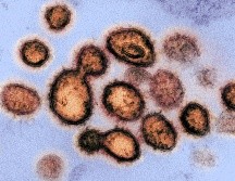 - (United States), 27/02/2020.- An undated handout picture made available by the National Institutes of Health (NIH) shows a transmission electron microscope image of SARS-CoV-2, the virus that causes COVID-19, isolated from a patient in the USA (issued 27 February 2020). Virus particles are shown emerging from the surface of cells cultured in the lab. The spikes on the outer edge of the virus particles give coronaviruses their name, crown-like. The novel coronavirus is on the verge of spreading across the world as more cases are emerging outside China with outbreaks in South Korea, Italy and Iran. (Italia, Corea del Sur, Estados Unidos) EFE/EPA/NIAID- RML/NATIONAL INSTITUTES OF HEALTH HANDOUT HANDOUT EDITORIAL USE ONLY/NO SALES Research on novel coronavirus 2019, National Institutes of Health-HANDOUT EDITORIAL USE ONLY/NO SALES