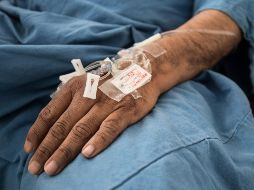 El Hongo Negro, anteriormente llamado cigomicosis, es por definición una infección fúngica grave, pero extraña, que es causada por un grupo de mohos llamados mucormicetos. NTX / ARCHIVO