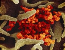 Las vacunas actuales se creen menos eficaces contra la variante Beta del virus, aunque todas ellas parecen ser muy efectivas para prevenir sus consecuencias más graves. AP / ARCHIVO