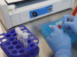 La muestra del paciente de COVID-19 fue enviada al Instituto de Diagnóstico y Referencia Epidemiológicos para confirmar que correspondía a la variante delta. EFE/ARCHIVO