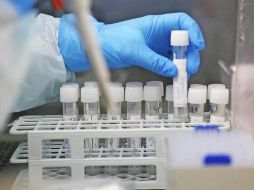 Jalisco es el tercer lugar nacional por número de muertes y quinto lugar en contagios confirmados. EFE/ARCHIVO