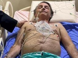 El propio Bolsonaro, en un mensaje en su perfil de Twitter, afirmó que la complicación sería consecuencia del atentado que sufrió en 2018, en medio de la campaña electoral que lo llevó al poder, cuando fue acuchillado en el abdomen. TWITTER / @jairbolsonaro