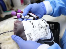 DONAR SANGRE. De debe tomar en consideración algunos aspectos antes de hacerlo, entre ellos, el tipo de vacuna recibida. PIXABAY