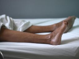El síndrome de Guillain-Barré paraliza los músculos, pero la mayoría de las personas que lo contraen eventualmente se recuperan. GETTY IMAGES