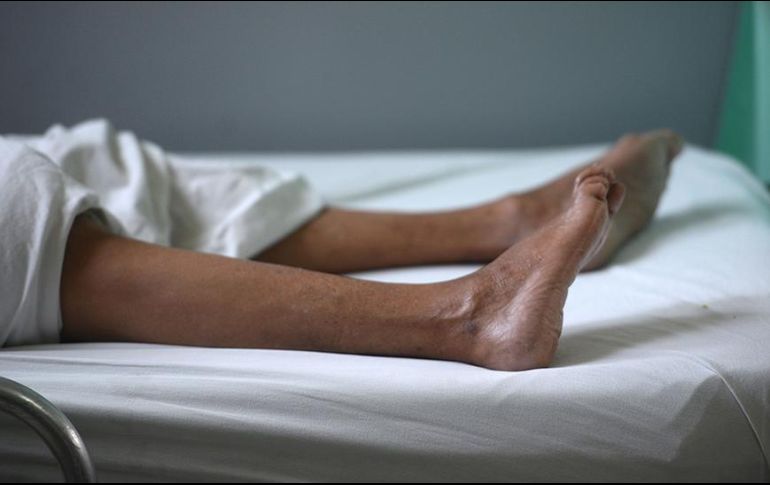 El síndrome de Guillain-Barré paraliza los músculos, pero la mayoría de las personas que lo contraen eventualmente se recuperan. GETTY IMAGES