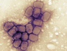 La enfermedad fue erradicada en 1980. GETTY IMAGES