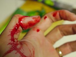 No es el primero. Se han registrado más casos de canibalismo en Alemania, en algunos se cree que la víctima deseaba ser comida. PIXABAY