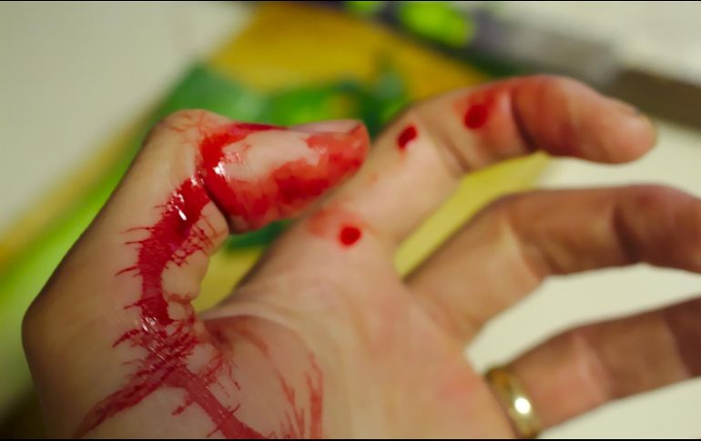 No es el primero. Se han registrado más casos de canibalismo en Alemania, en algunos se cree que la víctima deseaba ser comida. PIXABAY