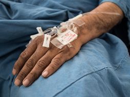 Los síntomas del síndrome de Guillain-Barré pueden durar unas pocas semanas, y la mayoría de los casos se recuperan sin complicaciones neurológicas graves a largo plazo, indica la OMS. NTX / ARCHIVO