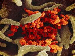 Algunos científicos advirtieron que si hay más demoras, la investigación para descubrir el origen del COVID-19 será muy difícil, desde el punto de vista biológico. AP / ARCHIVO