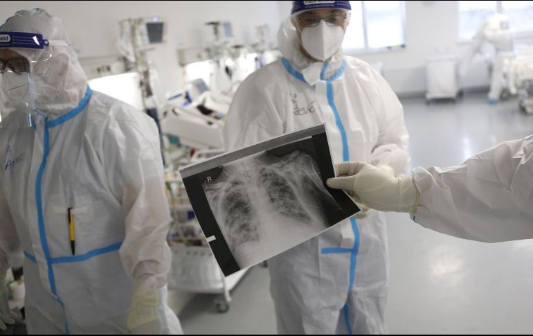 Para el estuido se recogieron muestras bacterianas y fúngicas de los pulmones de enfermos de COVID-19 hospitalizados en Estados Unidos. EFE/ARCHIVO