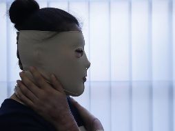 En México, 27 mujeres han sufrido ataques con ácido. Tan solo en 2021, seis víctimas denunciaron sus casos. SUN / ARCHIVO