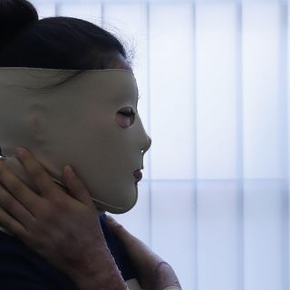 A 2 años del ataque, María Elena enfrenta a diario revictimización