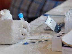 La semana pasada se reportaron unos cuatro millones de contagios en todo el mundo, según la OMS, el primer descenso importante en los casos nuevos en más de dos meses. EL INFORMADOR / A. Camacho