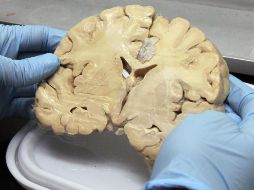 El riesgo genético en la población de que se presente el Alzheimer es de 15% a 35% si lo tuvo algún familiar con anterioridad. NTX/ARCHIVO