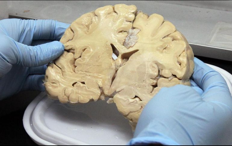 El riesgo genético en la población de que se presente el Alzheimer es de 15% a 35% si lo tuvo algún familiar con anterioridad. NTX/ARCHIVO