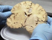 El riesgo genético en la población de que se presente el Alzheimer es de 15% a 35% si lo tuvo algún familiar con anterioridad. NTX/ARCHIVO