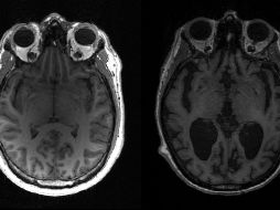 Se reveló que el proceso de multiplicación de los agregados es lento. AFP/ T. Rittman