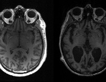 Se reveló que el proceso de multiplicación de los agregados es lento. AFP/ T. Rittman