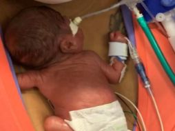 Curtis Means tiene el Récord Guinness del bebé más prematuro del mundo con 420 gramos al nacer. ESPECIAL