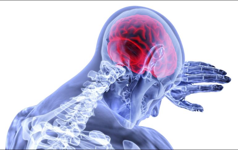 Según la Secretaría de Salud, el derrame cerebral es una de las principales causas de muerte en México. PIXABAY