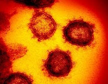 Ómicron, que presenta un elevado número de mutaciones y una resistencia importante a las vacunas, fue identificado por primera vez en Botsuana y Sudáfrica a finales de noviembre. AP/NIH/ARCHIVO