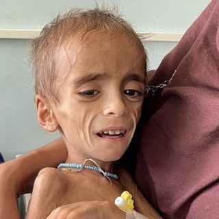 "Una joven rogaba que la mataran a ella y a su bebé": el hospital en Afganistán donde los niños mueren de desnutrición