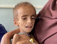 Un niño con desnutrición en Kandahar, en Octubre. GETTY IMAGES