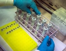 Instan a todos los países a que contribuyan a la evaluación transmitiendo sus datos a la OMS, pues es demasiado pronto para estar seguros de que la variante ómicron sea menos grave. AP / J. Delay