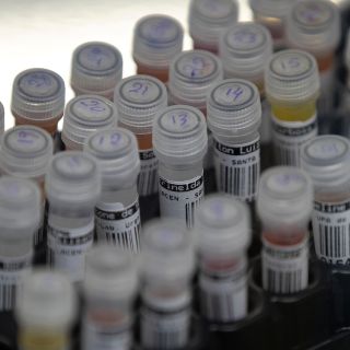 Vacuna contra VIH: Prometedores resultados en sus pruebas con animales