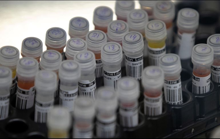 Las pruebas para la creación de la vacuna contra el VIH son muy prometedoras.  EFE/ ARCHIVO
