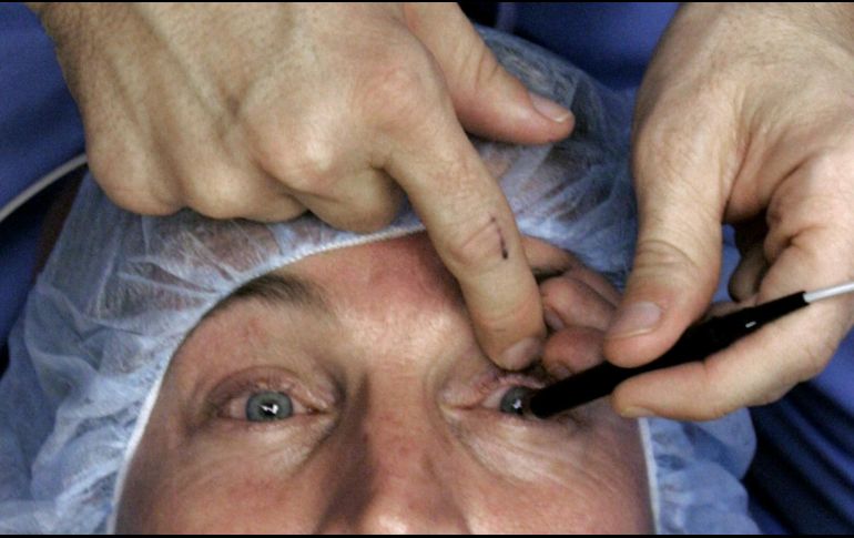 Según el  Instituto Oftalmológico Fernández-Vega, el 91.3 % de los pacientes presentaron alteraciones en el tejido nervioso corneal. AP / ARCHIVO