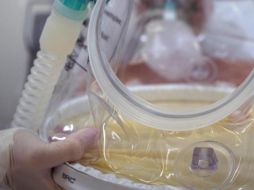 El campeón mundial de kickboxing, Frédéric Sinistra, falleció a causa de COVID-19, luego de mostrar su postura anti vacunas y asegurar que no la necesitaba. EFE / ARCHIVO