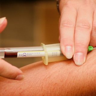 ¡Cuida tu corazón! Estos alimentos tapan las arterias