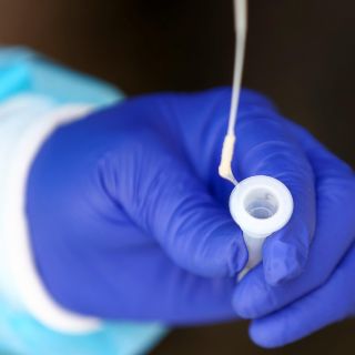 Ómicron: La UdeG analiza al menos otros tres casos de la nueva cepa de COVID