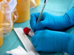 Con 30 mil 671 nuevos casos de COVID-19 registrados ayer sábado, México rompió el máximo de contagios en un día. AP / ARCHIVO